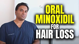 Oral Minoxidil For Hair Loss [upl. by Knowling]