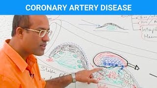 The Easy Way to Understand Congenital Heart Disease 🫀  Cardiology [upl. by Alva]