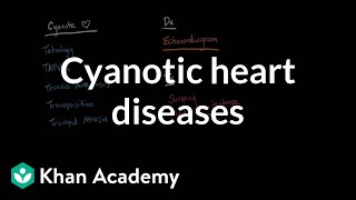 Pediatric cardiac defects  Acyanotic amp Cyanotic [upl. by Zebulon]