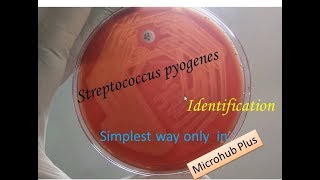 Streptococcus pyogenes identification [upl. by Suivatnom]