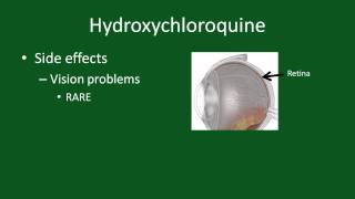 Hydroxychloroquine for Rheumatoid Arthritis [upl. by Ytinirt]