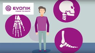 Biomaterials for Medical Devices  Evonik [upl. by Farmer706]