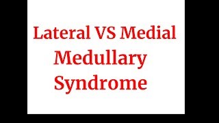 Lateral VS medial medullary syndrome [upl. by Liahkim]