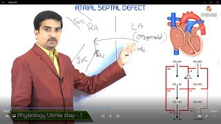 Atrial Septal Defects by D Bailly  OPENPediatrics [upl. by Ytirahc]