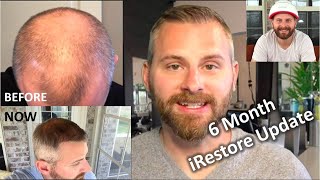 6 MONTH Review amp Results from iRestore Low Level Laser Therapy LLLT [upl. by Yesnil635]