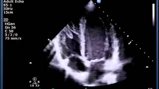 Understanding Echo Standard Imaging Views [upl. by Enelrak464]