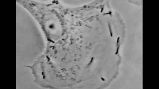 Listeria monocytogenes [upl. by Hameean]