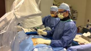 Kyphoplasty Procedure Part 1 – Parkway Surgery Center [upl. by Lananna]