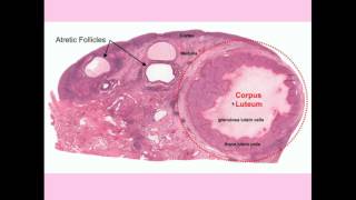 Ovarian Cysts  CRASH Medical Review Series [upl. by Dawkins]