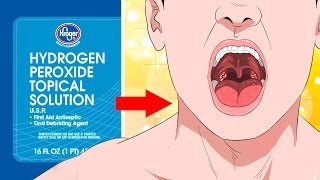 7 Natural remedies for Sore Throat  Dr Priya Jain [upl. by Adnovaj441]