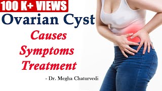 Ovarian Cyst Causes Symptoms and Treatment [upl. by Gib]