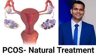 What is an Ovarian Cyst  Dr Shagufta Siraj [upl. by Spencer]