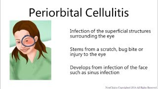 Perivascular spaces [upl. by Llevel731]