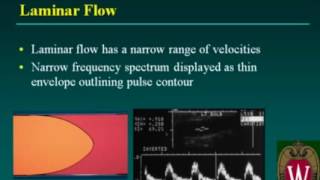 Carotid Sonography Doppler Evaluation and Waveform Analysis [upl. by Eevets]