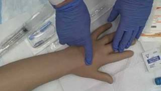 Intravenous IV Saline Lock Insertion [upl. by Leonie836]