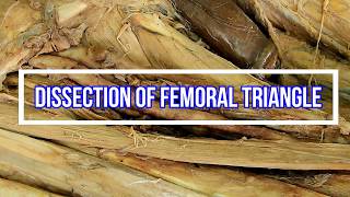 Dissection of Femoral Triangle [upl. by Ahtebbat]