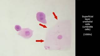 INTERPRETATION OF URINE CYTOLOGY Atlas and tutorial for cytotechnologist learning [upl. by Reeves]