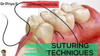 SUTURING TECHNIQUESDEMONSTRATION [upl. by Tav738]