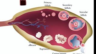 Ovarian Cysts [upl. by Soigroeg]