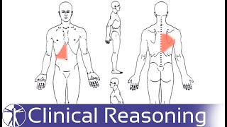 Screening for Visceral Referred Pain in the Thoracic Spine [upl. by Swinton]