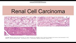 How to read an adrenal protocol CT scan  adrenal washout [upl. by Pierre]