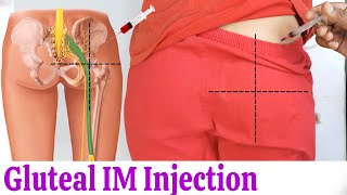 How to give IM Intramuscular injection in buttock or hip easily at home  Dorsogluteal Injection [upl. by Sinaj]