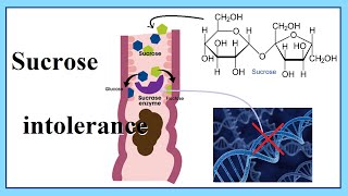 sucrose intolerance [upl. by Kathleen177]